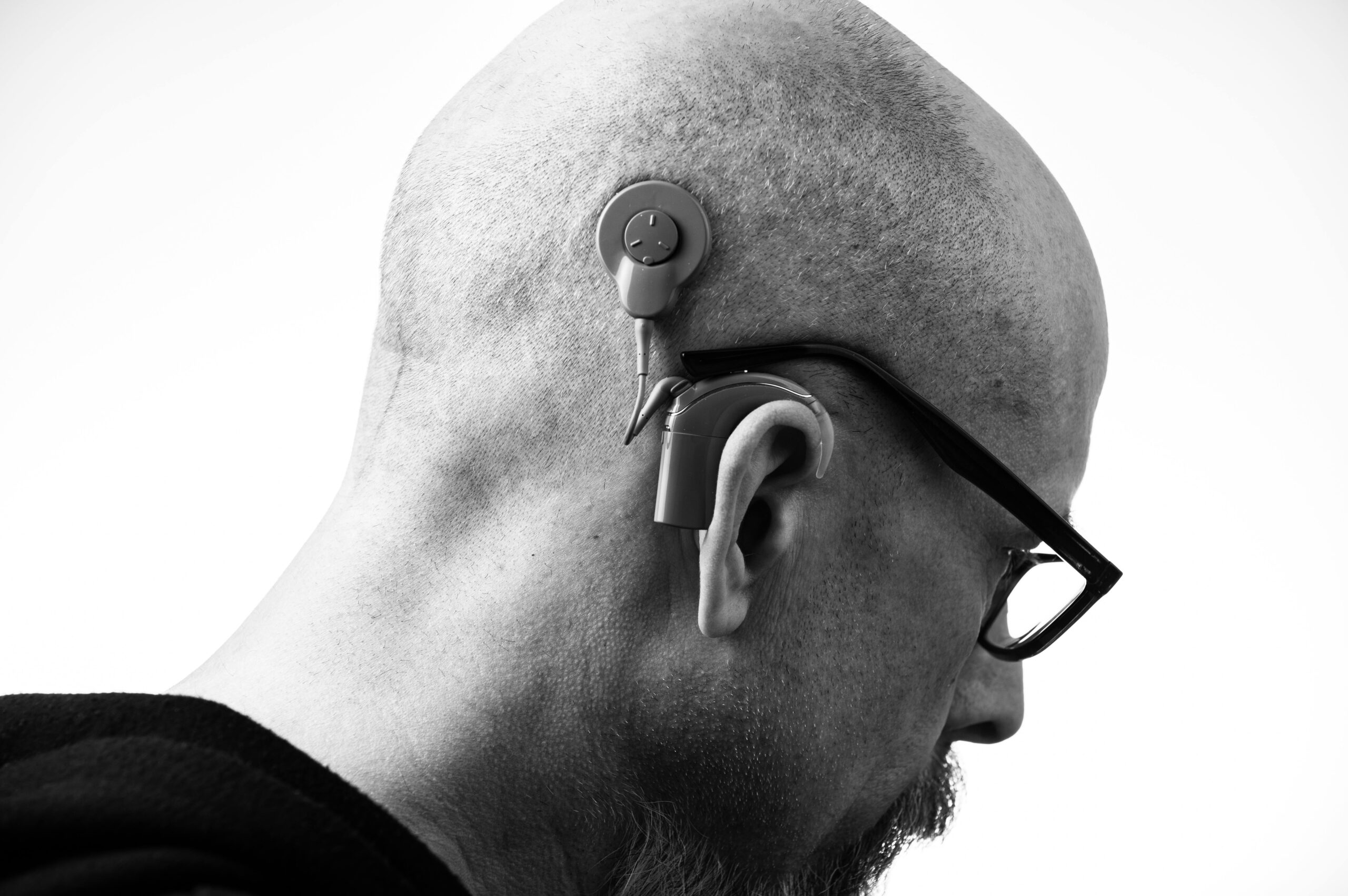 Hearing Aids Inside Out - Image 3