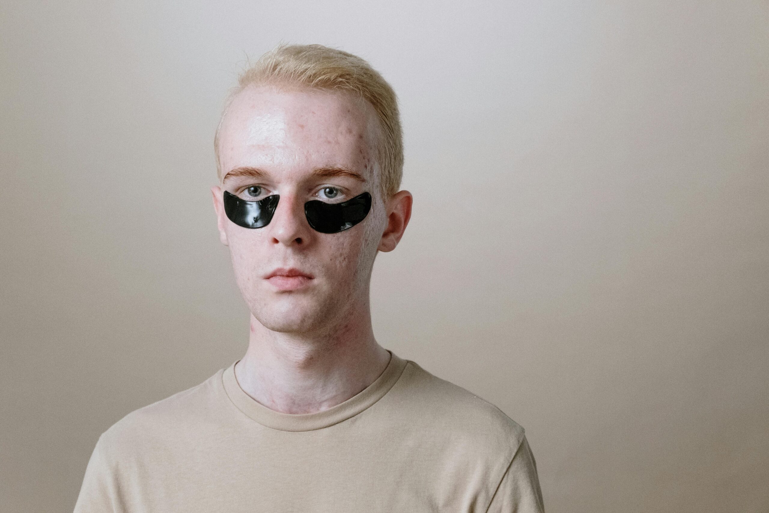How To Win Your War Against Acne. - Image 2