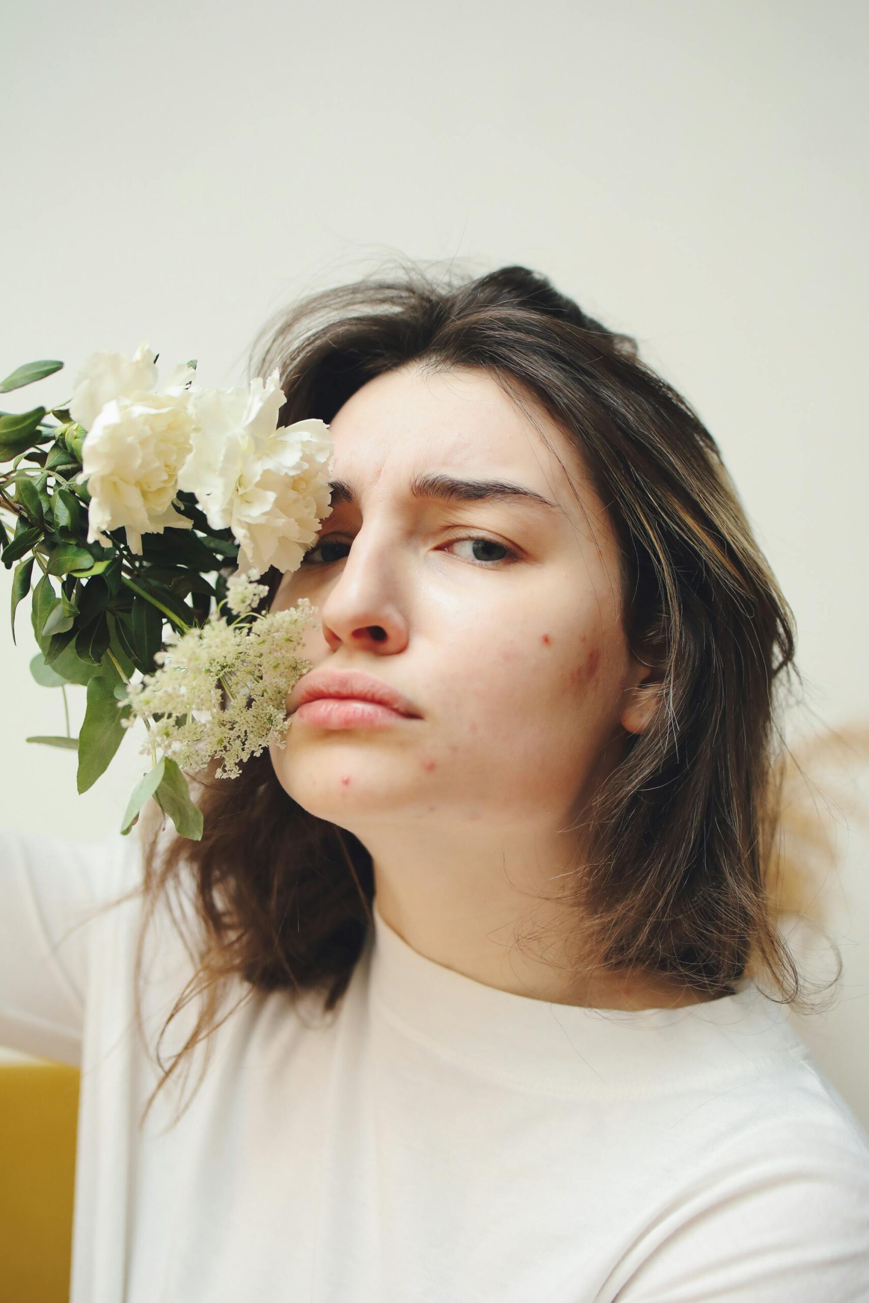 How To Win Your War Against Acne. - Image 6